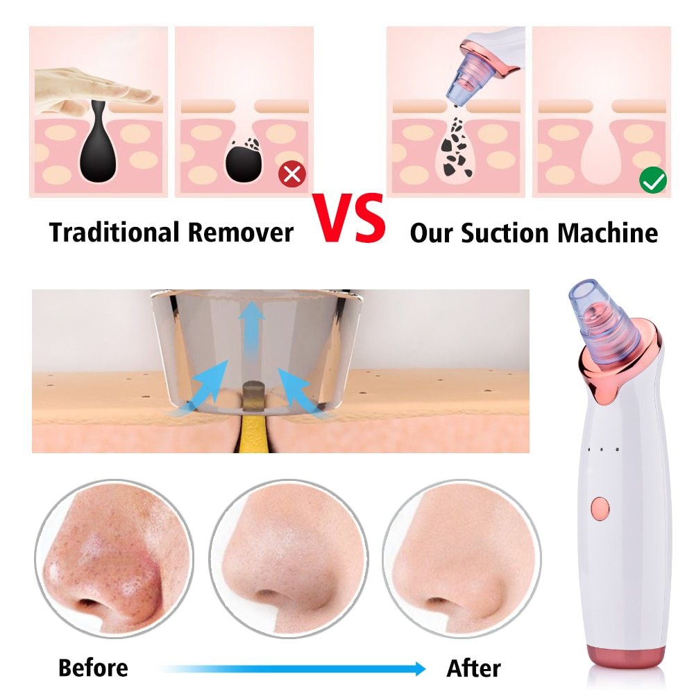 Instrument de nettoyage des points noirs par aspiration électrique pour le visage, instrument de beauté pour l'acné.