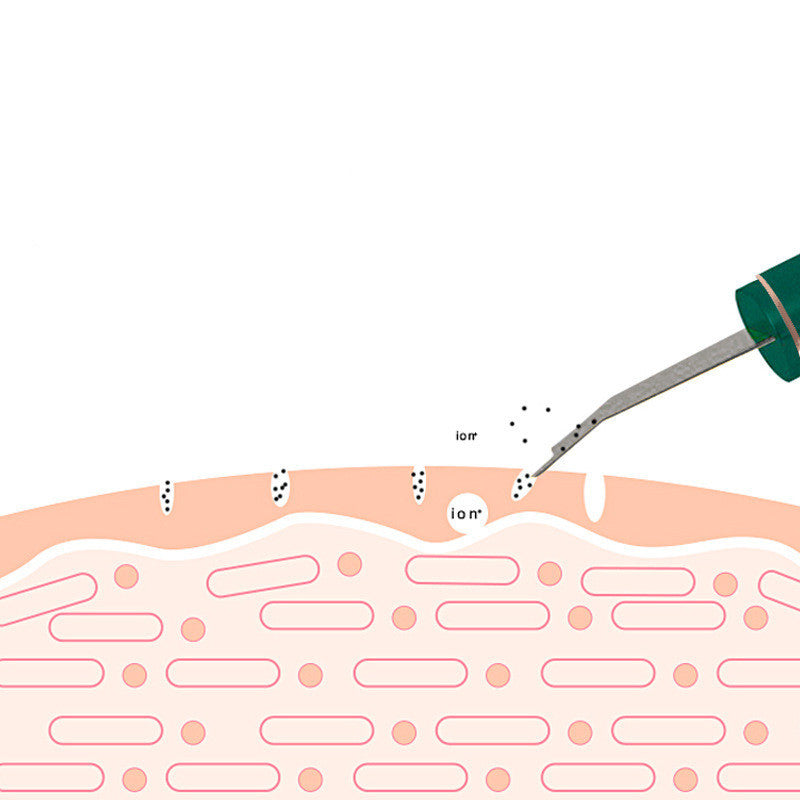Machine de gommage éclaircissante pour le rajeunissement de la peau par ultrasons