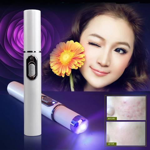 Blue Light Laser Treatment Device for Acne Therapy Pen Skin Care Device for Soft Scar and Wrinkle Removal. 